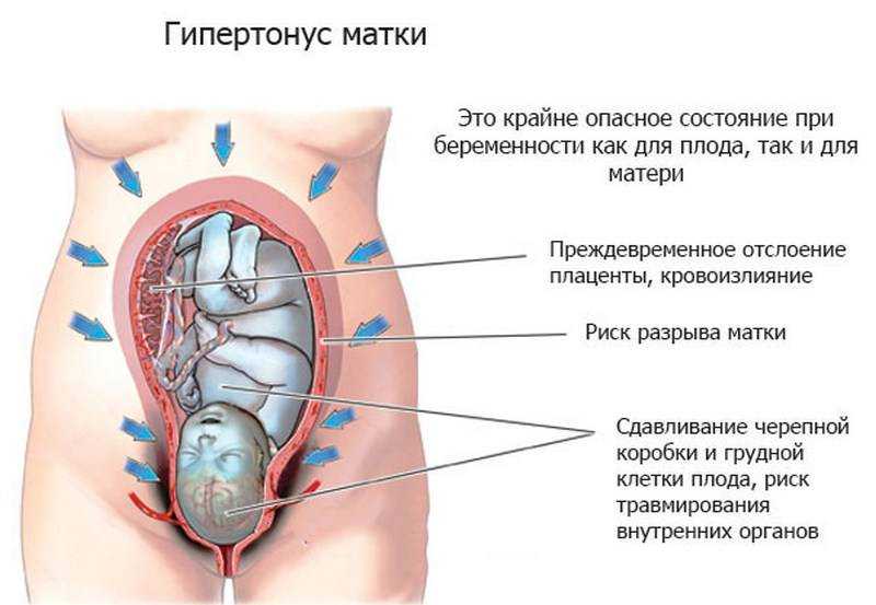 Пульсация в животе при беременности, тикает, дергает, если внизу живота, в правом боку, левом, возле пупка, в матке на ранних сроках
