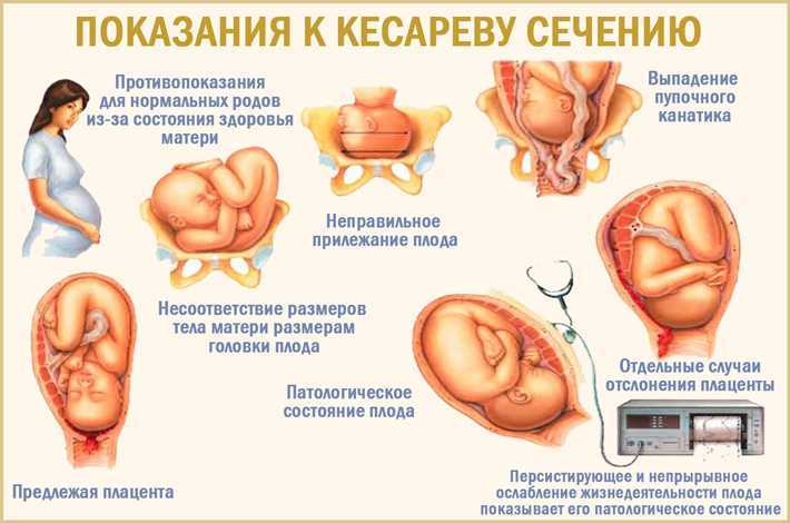 Рубец на матке: какие опасности подстерегают во время беременности