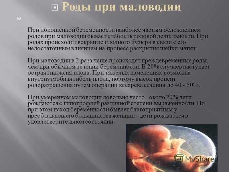 Как определить крупный плод, и что делать маме / mama66.ru