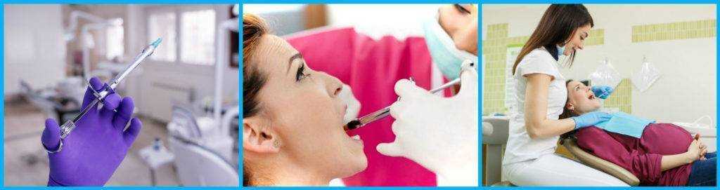 Особенности лечения зубов при беременности в 1, 2, 3 триместре