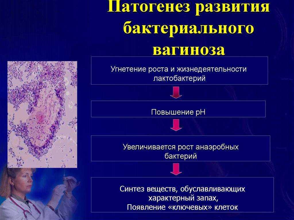 Бактериальный вагиноз при беременности: симптомы, причины, лечение свечами
