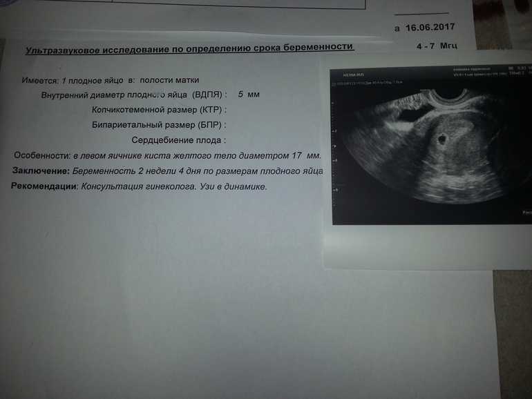 Для чего нужен узи-скрининг во время беременности и не опасен ли он • центр гинекологии в санкт-петербурге