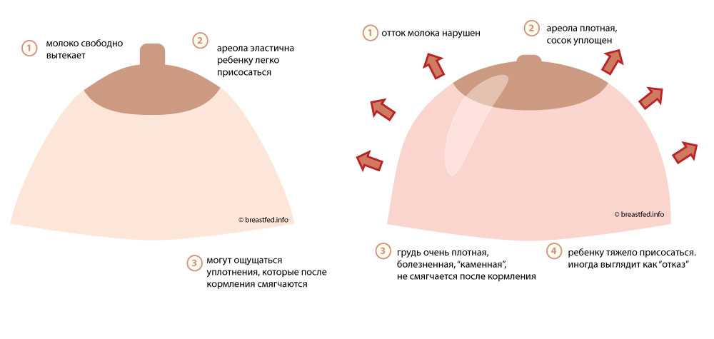 Грудь на ранних сроках беременности: какие изменения происходят / mama66.ru