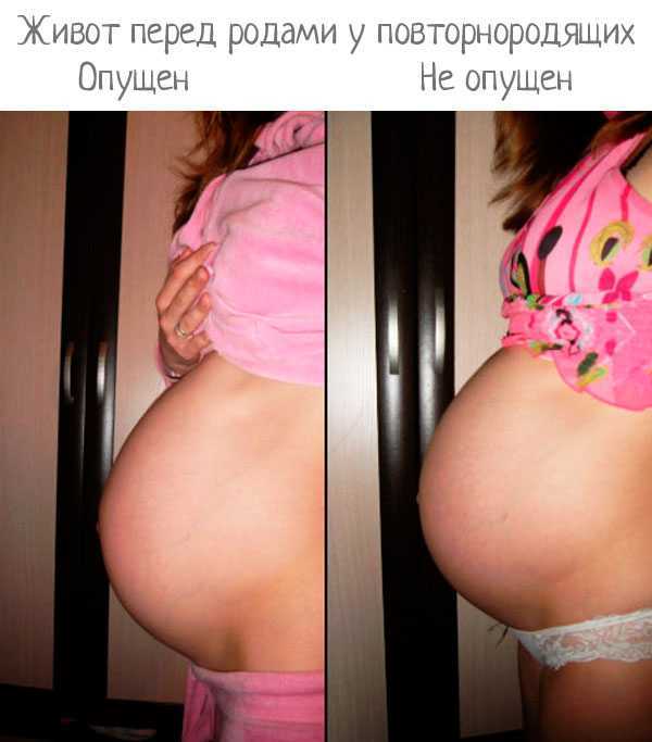 Беременность по неделям: развитие плода и ощущения женщины, фото