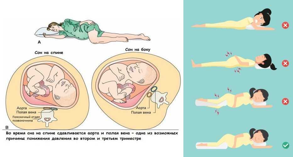 Как правильно спать беременной: можно ли беременной спать на животе, спине и на боку