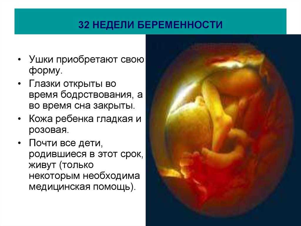 32 недели беременности: что происходит с малышом и мамой. что делает малыш