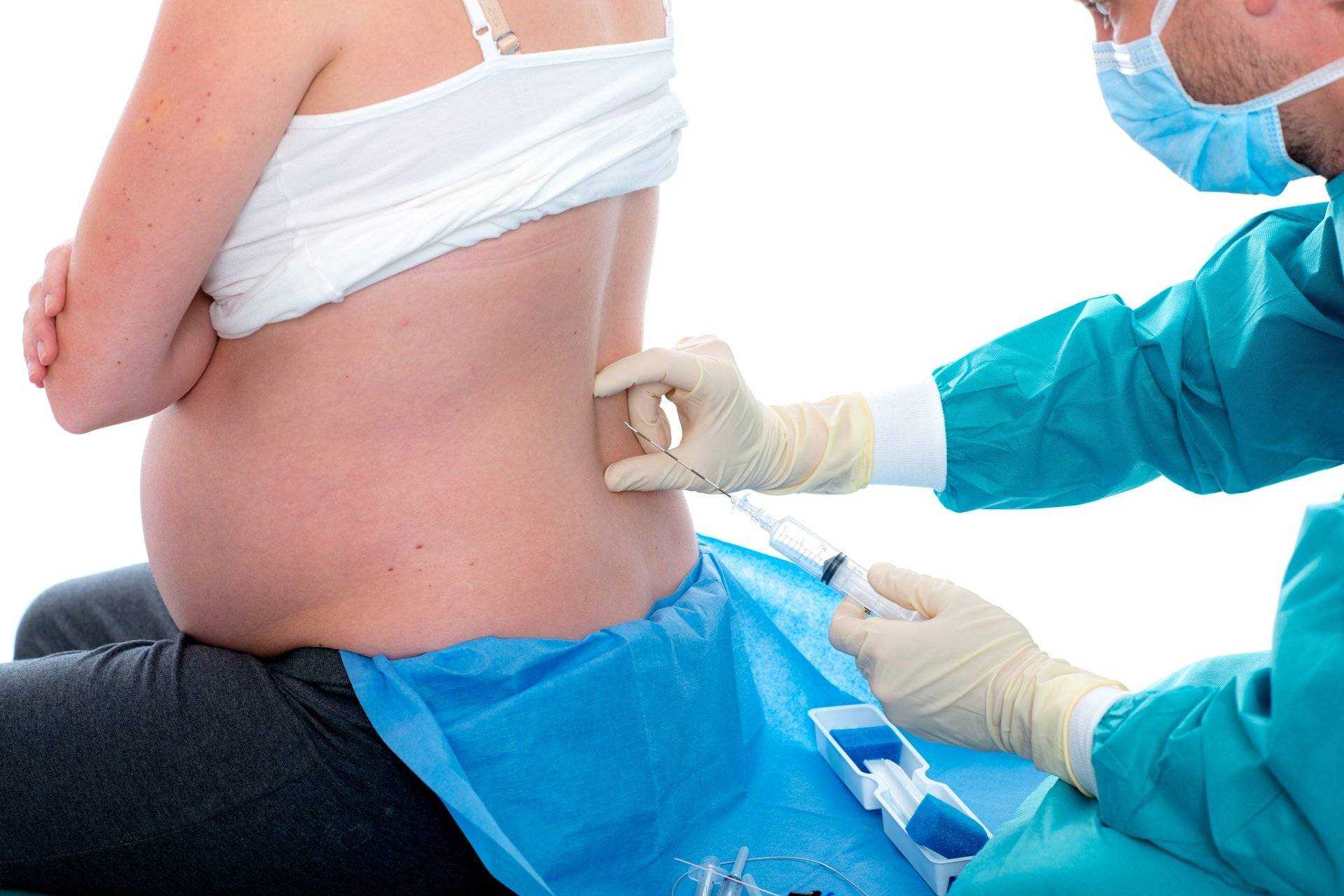 Родоразрешение пациенток с рубцом на матке после кесарева сечения » акушерство и гинекология