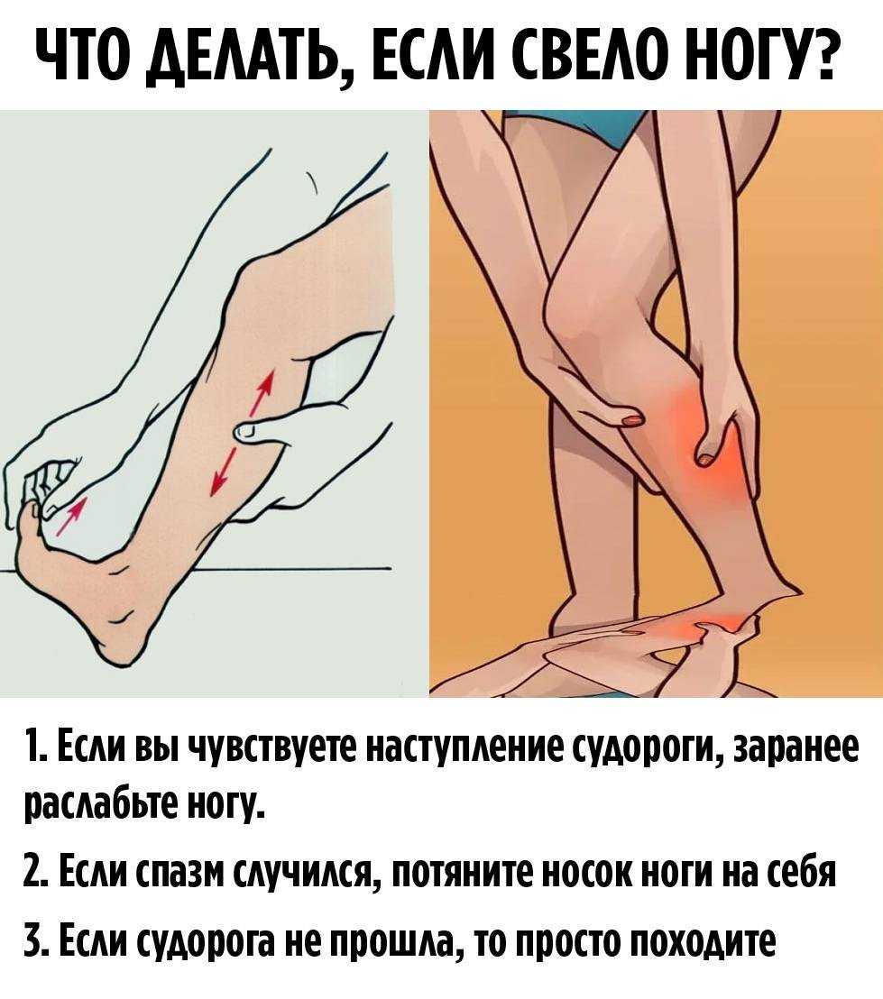 Боли в ногах при беременности: причины и лечение / mama66.ru