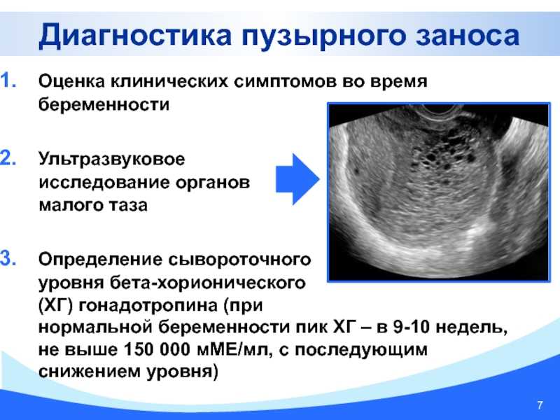 Аденоматоз матки: лечение и диагностика аденоматоза эндометрия матки в клинике «евроонко»