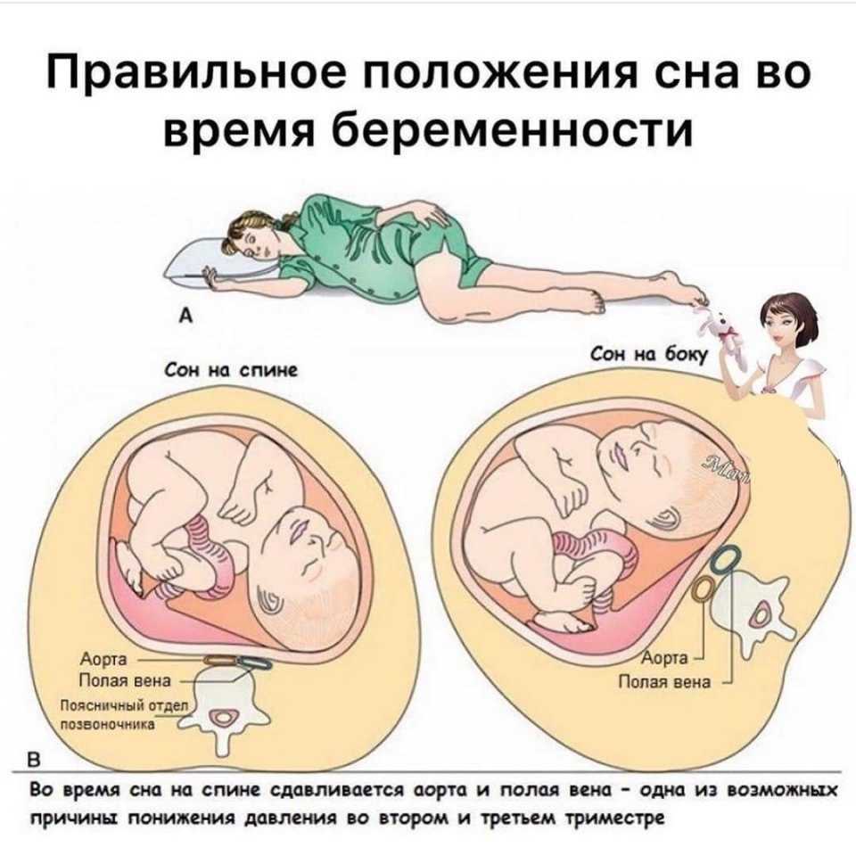Почему и с какого срока беременным нельзя спать на спине, как правильно спать во время беременности