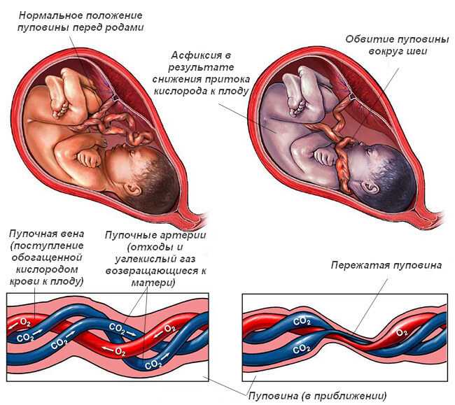 Крупный плод при беременности: как рожать?