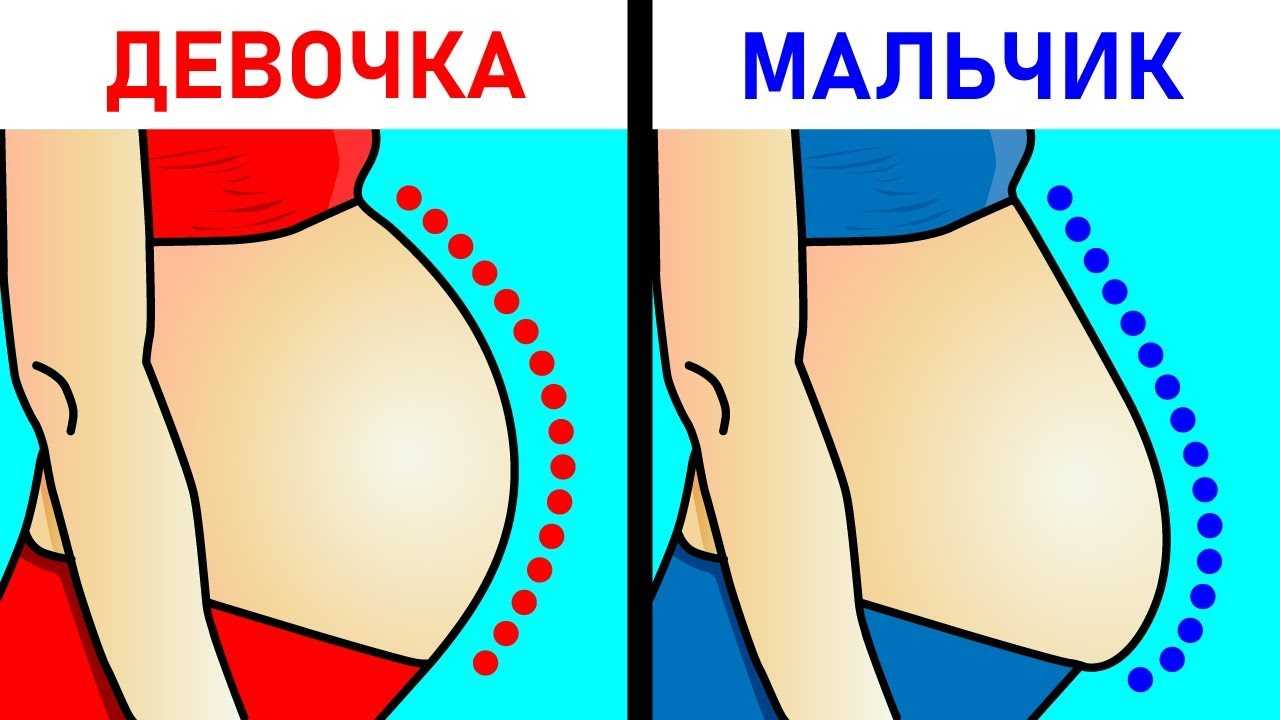 Беременность мальчиком и девочкой: отличия, проверенные признаки, особенности на ранних сроках | nail-trade.ru