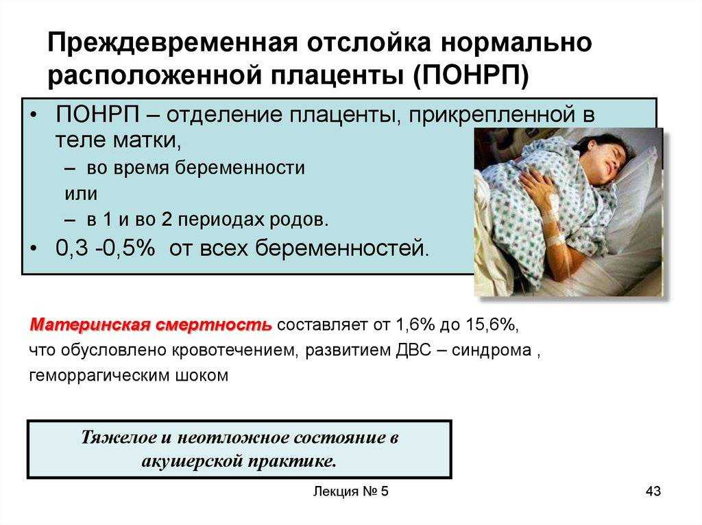 Отслойка плаценты: симптомы на ранних сроках беременности, на поздних сроках, причины и лечение - medside.ru