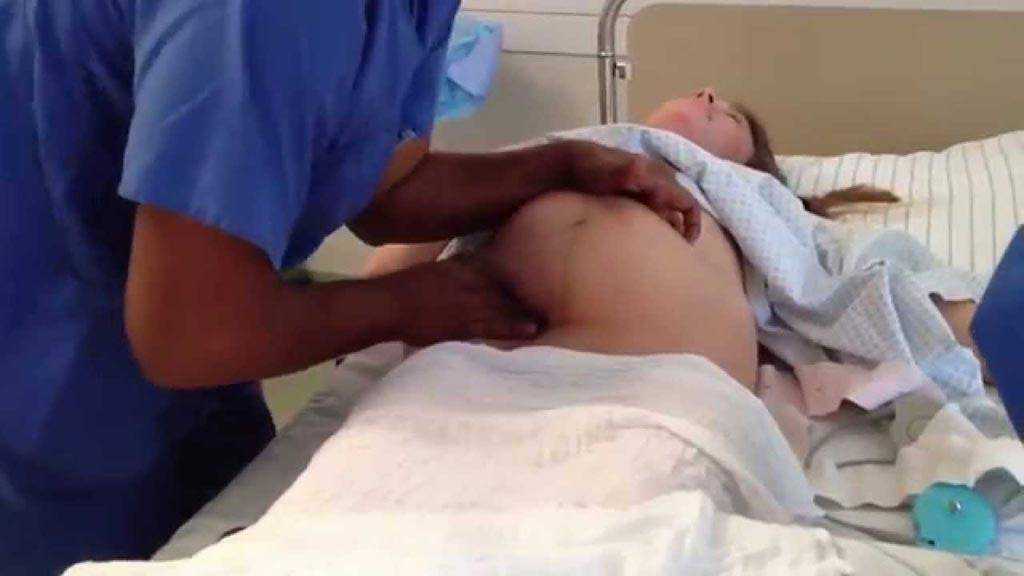 Узи после родов: норма размеров матки, узи рубца после кесарева сечения