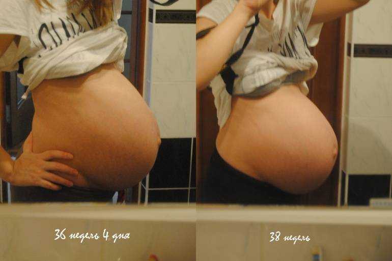42 неделя беременности - мапапама.ру — сайт для будущих и молодых родителей: беременность и роды, уход и воспитание детей до 3-х лет