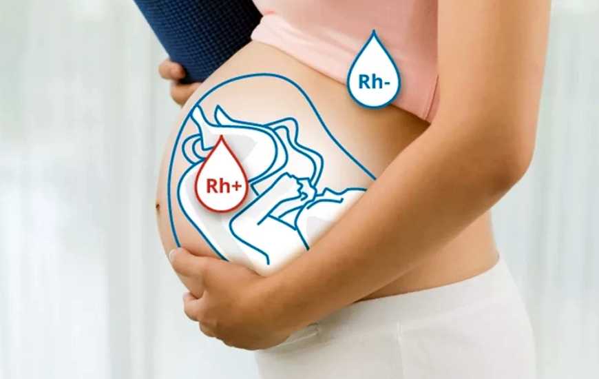 Беременность и резус