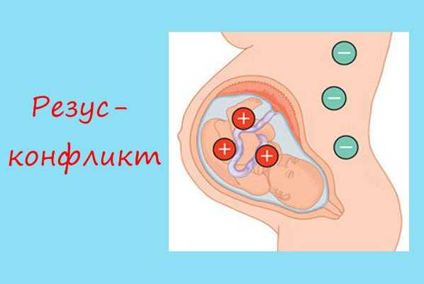 Резус-фактор и резус-несовместимость • резус-конфликт при беременности- тов «бiокор текнолоджi лтд»