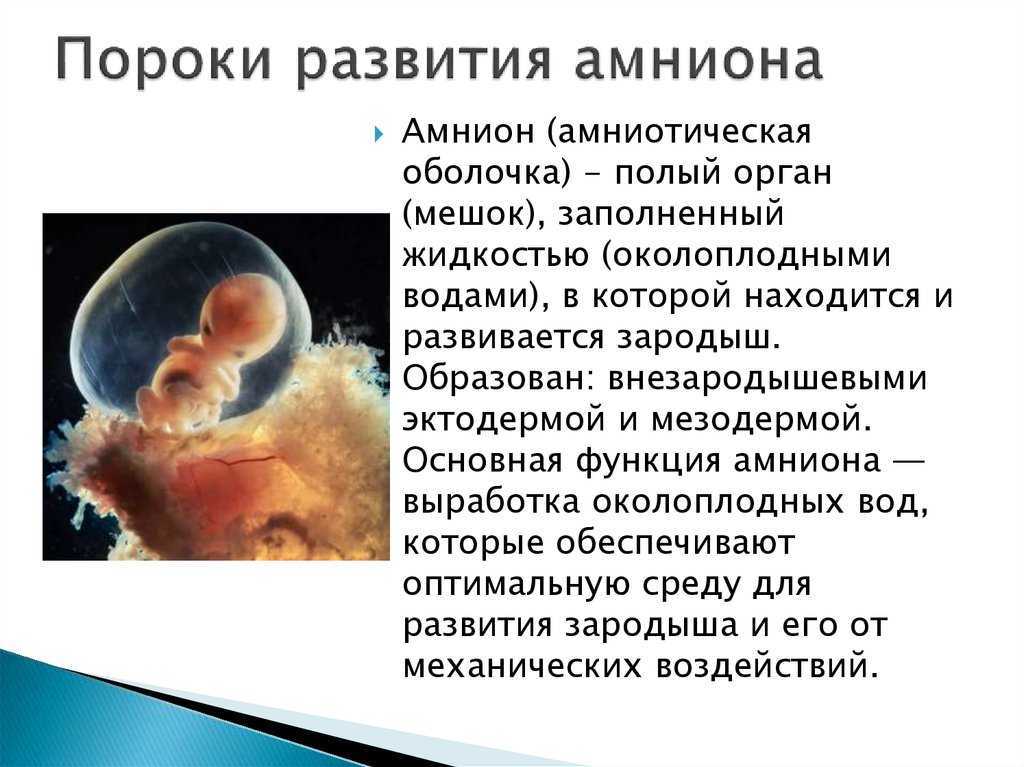 Многоводие при беременности: причины и последствия. лечение многоводия