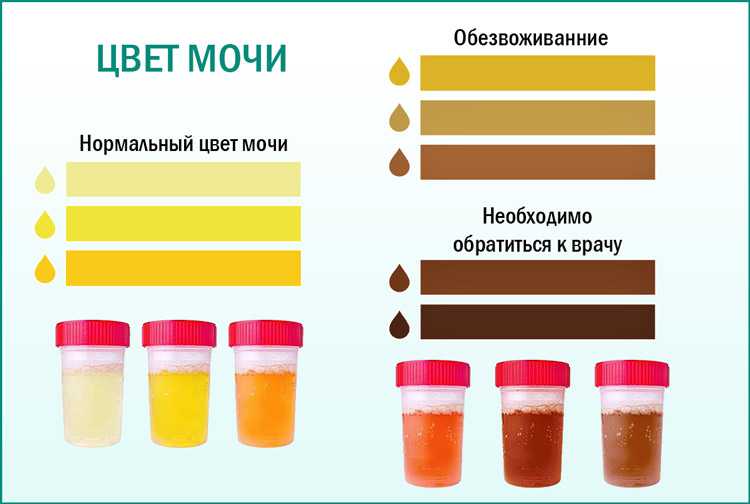 Общий анализ мочи при беременности