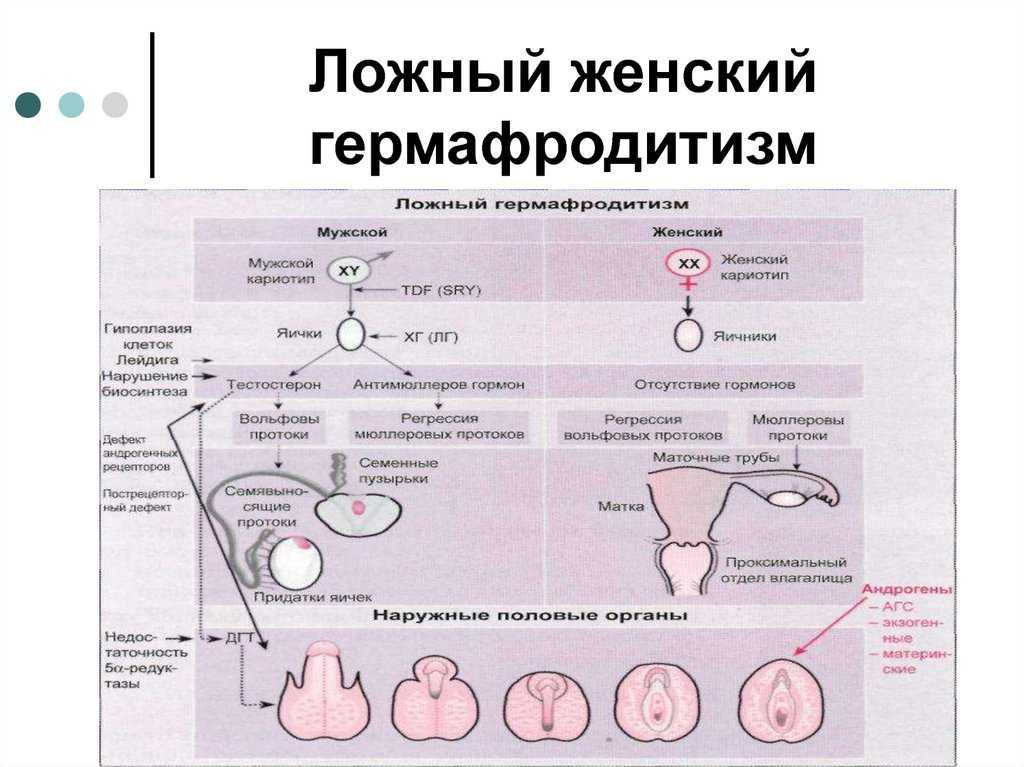 Гермафродитизм