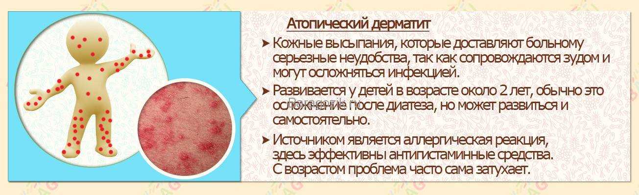 Кожный инфекционный дерматит у детей и взрослых: причины, лечение