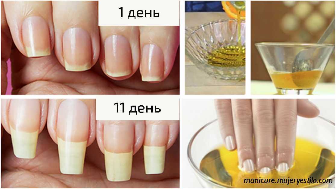 Как отрастить ногти за неделю