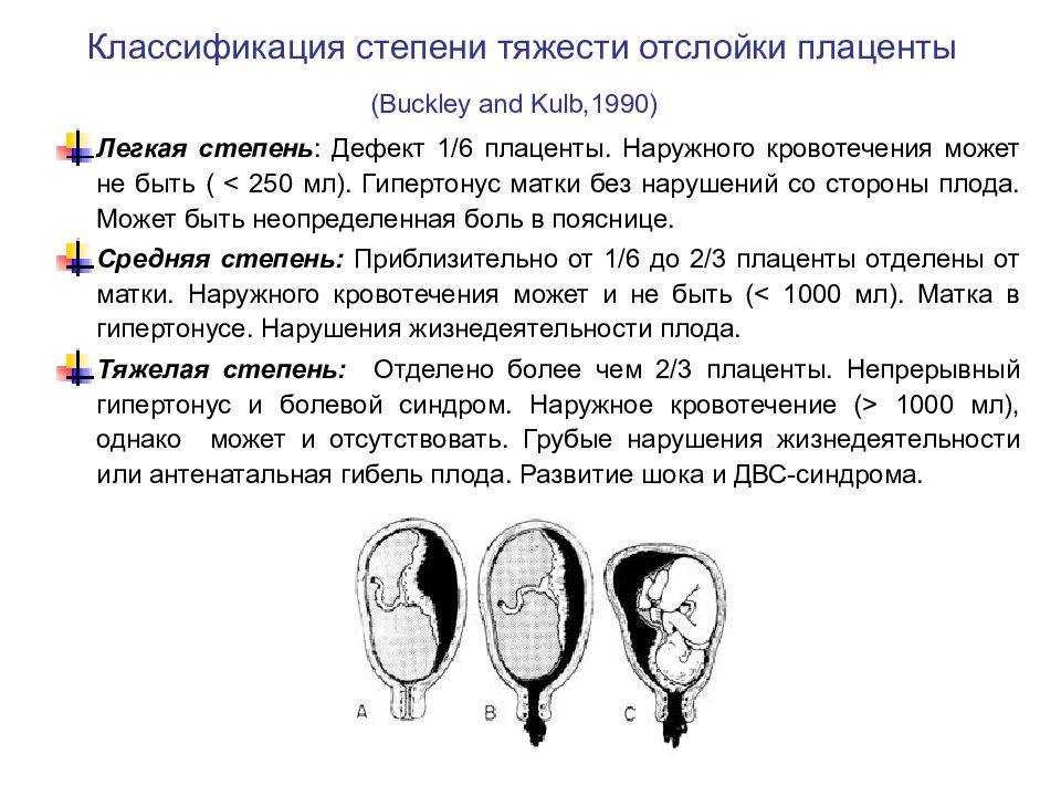 Отслойка плаценты на поздних сроках беременности: причины и последствия