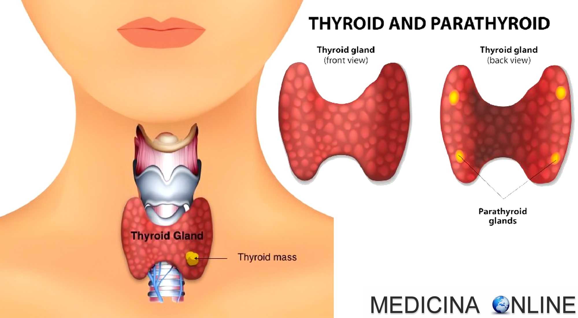 Кисты в щитовидной железе что это. Щитовидная железа рисунок. Щитовидная железа человека. Узловые образования щитовидной железы.