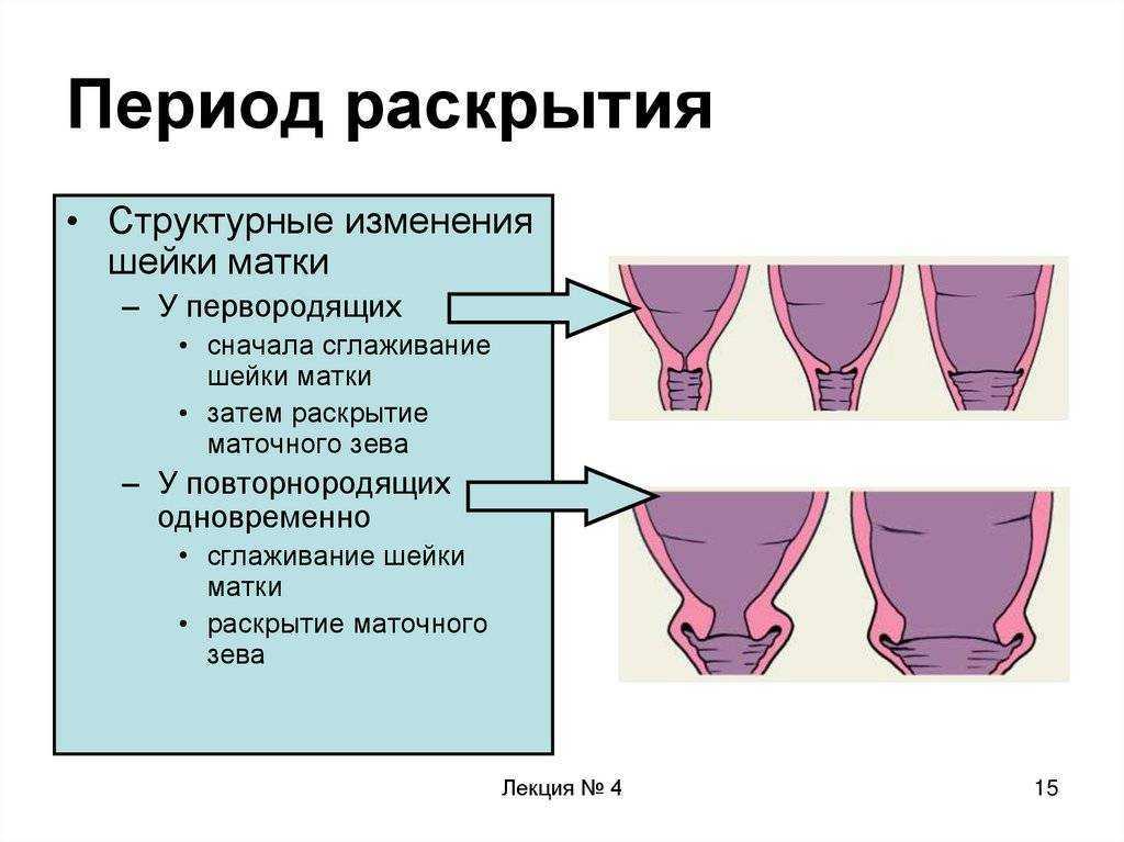 Упражнения для стимулирования родовой деятельности