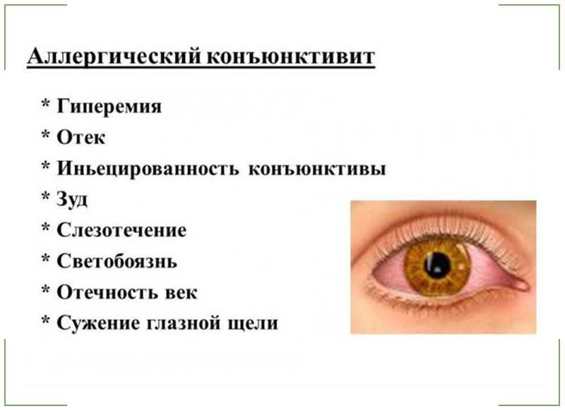 Если у ребенка чешутся глаза, то это может быть аллергия, конъюнктивит, инородное тело, усталость Важно выяснить причину и начать лечение