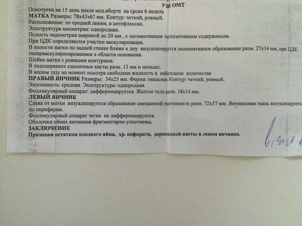 Что представляют собой искусственные роды, как проходят, показания к проведению, последствия, отзывы