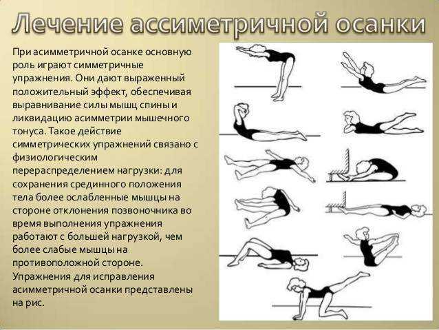 Каждый год в России рождается около 200 детей со спинальной мышечной атрофией СМА Большинство из них при рождении выглядят зд