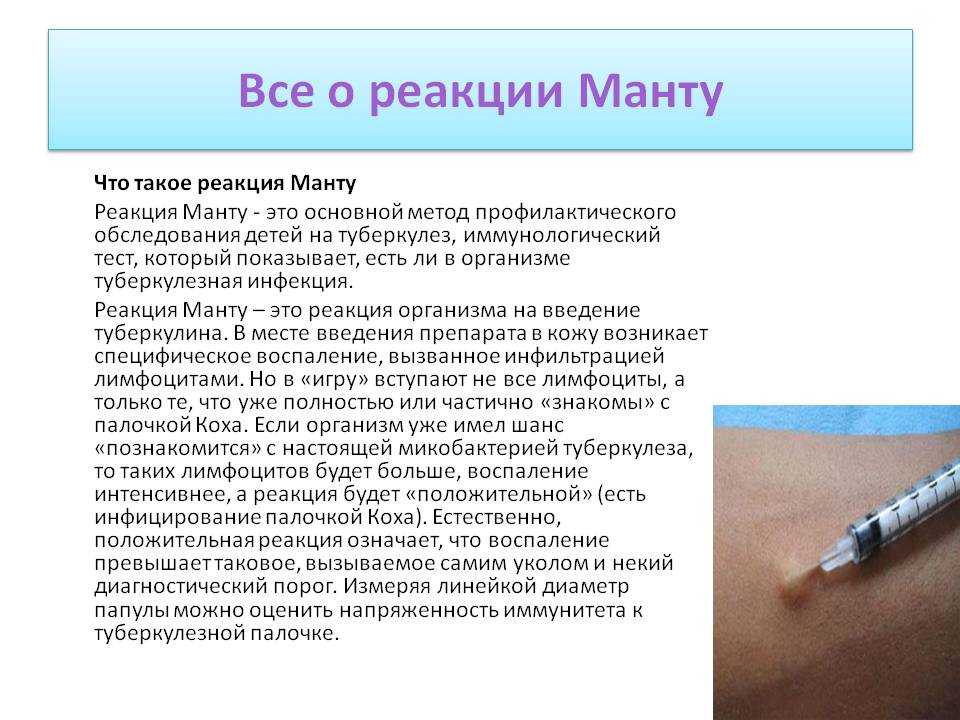 Проба манту: для чего делают, размеры, оценка и интерпретация результата у детей