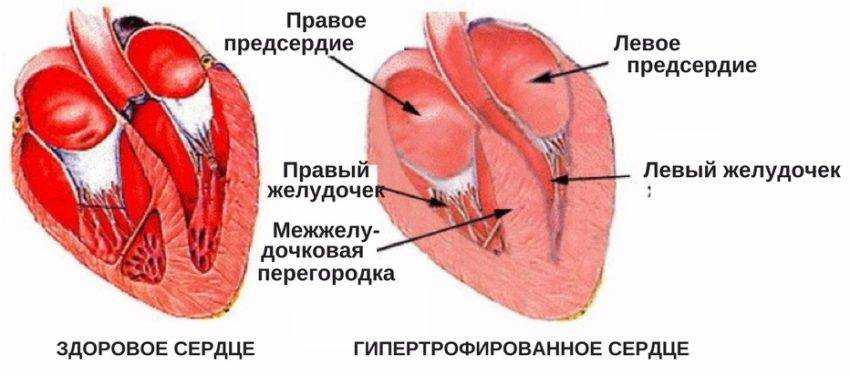 Корковая дизартрия у детей: причины, симптомы, лечение и прогноз