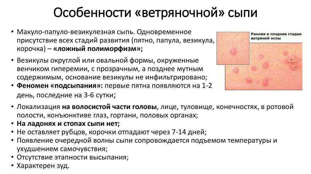 Пузырчатка: причины, виды, лечение, заживление и препараты