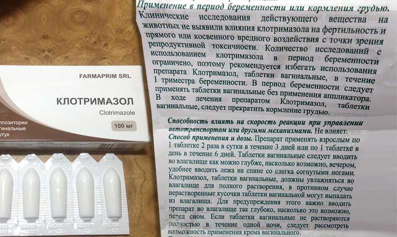 Выделения с запахом из влагалища