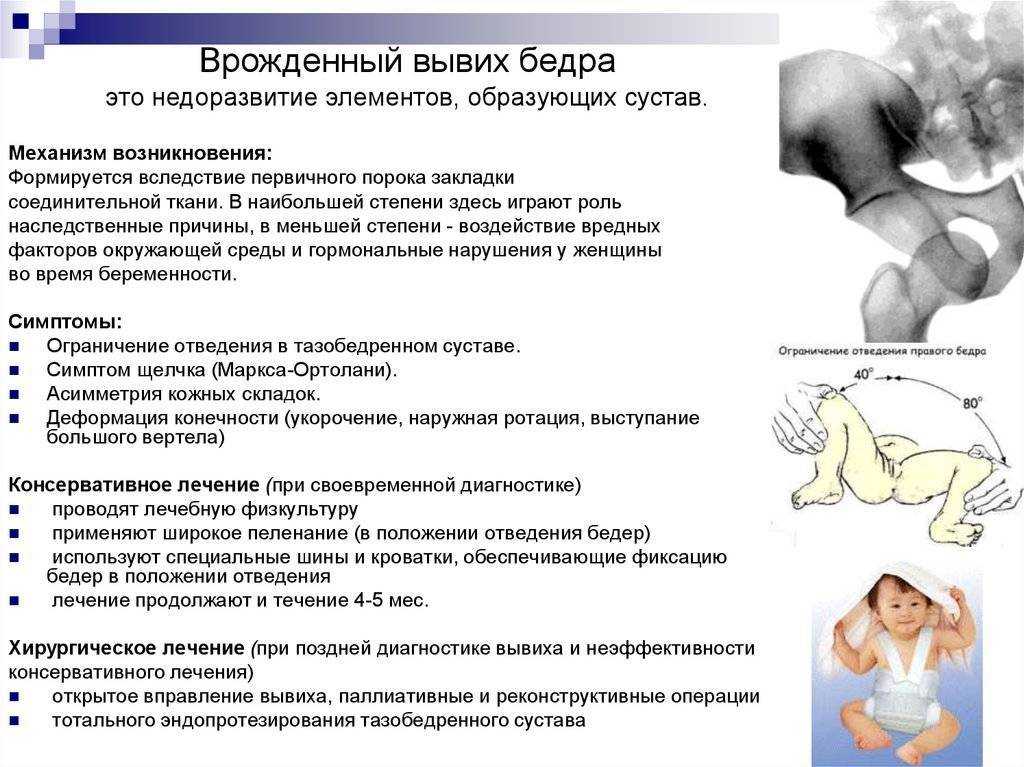 Рентген (рентгенография) тазобедренного сустава у детей