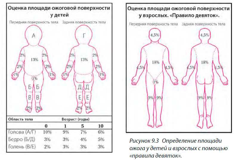 «секунда — и ребенок падает на раскаленные угли». врач ожогового отделения — о родительской беспечности и тяжелом лечении | правмир