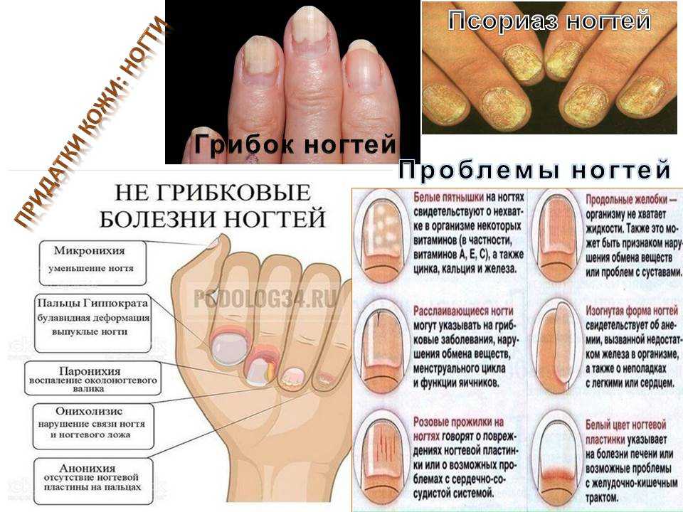 Патология ногтевых пластин