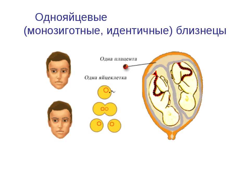 Однояйцевые и разнояйцевые близнецы — в чем отличие? | дом, семья, беременность