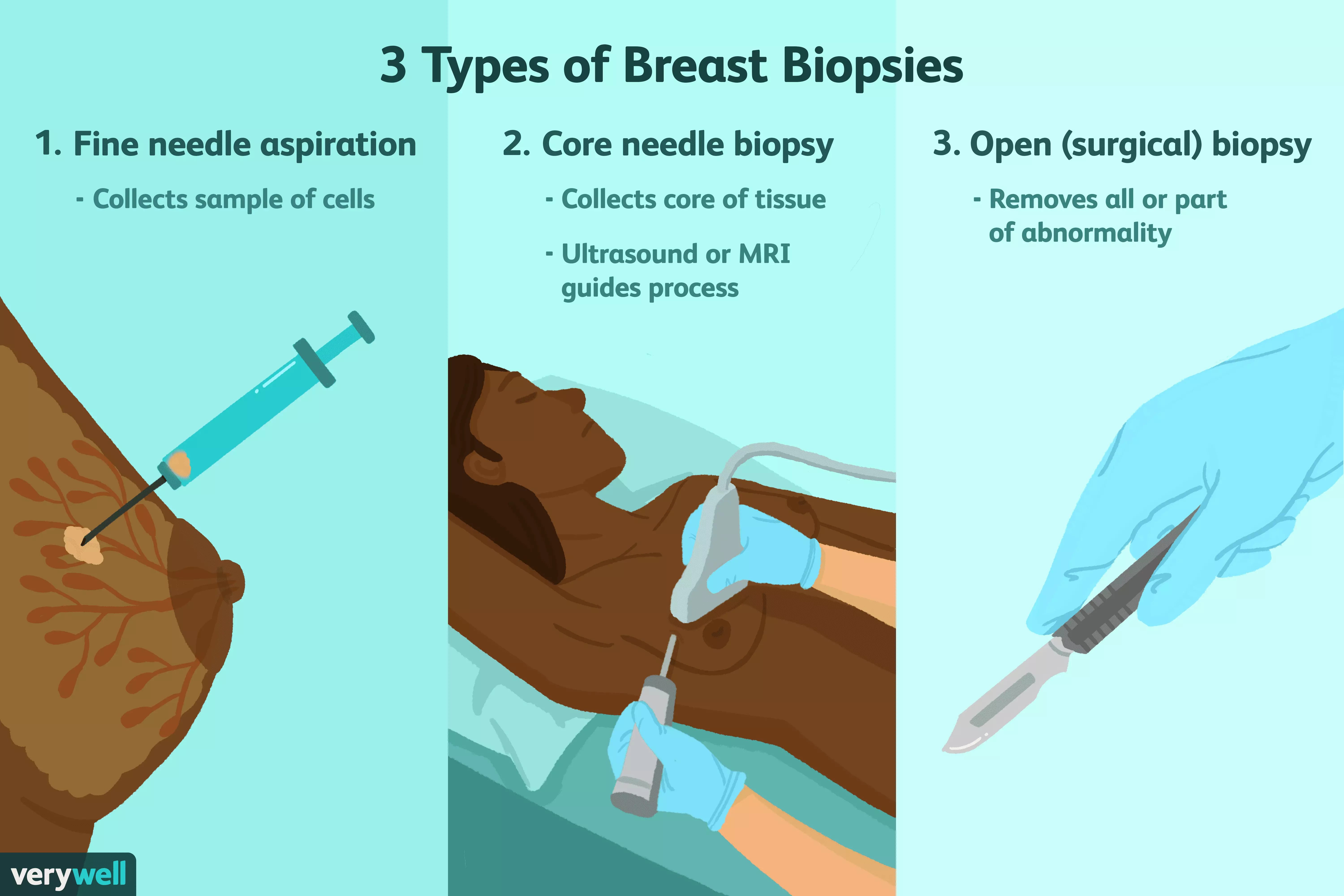 как делают биопсию груди у женщин фото 14