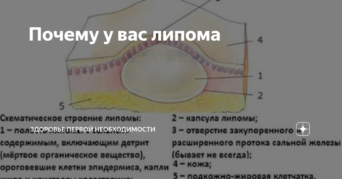 Что делать, если появились высыпания на коже младенца? | детская городская поликлиника № 32
