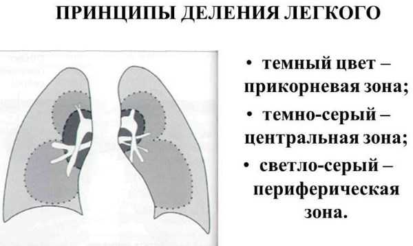 Как выявить пневмонию?