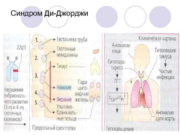 Синдром ди джоржи симптомы и лечение в вао — евромедклиник 24