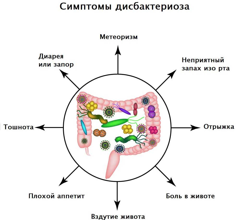 Дисбактериоз кишечника: норма и отклонения