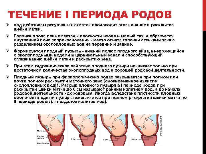 Как понять, что отошли воды при беременности? отошли воды, а схваток нет – что делать