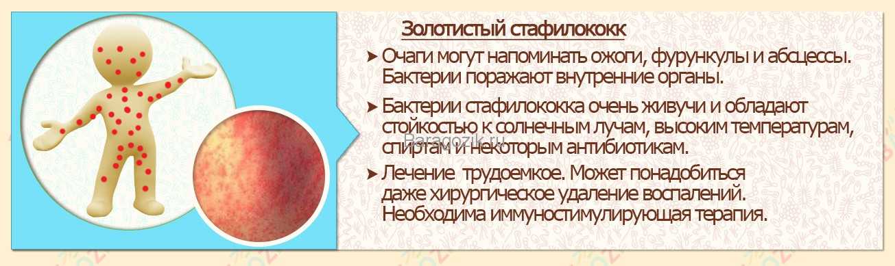 Аллергия на подгузники: как выглядит и что делать | сыпь и покраснения под подгузником у ребенка
