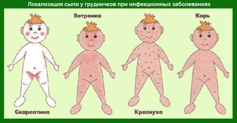Акне новорожденных статьи от Huggies