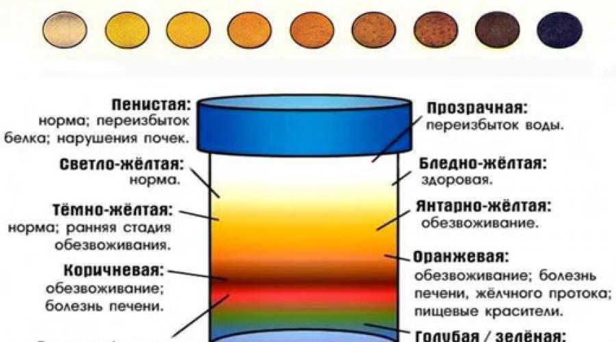 Изменение физических и химических показателей в анализах мочи при различных заболеваниях | университетская клиника