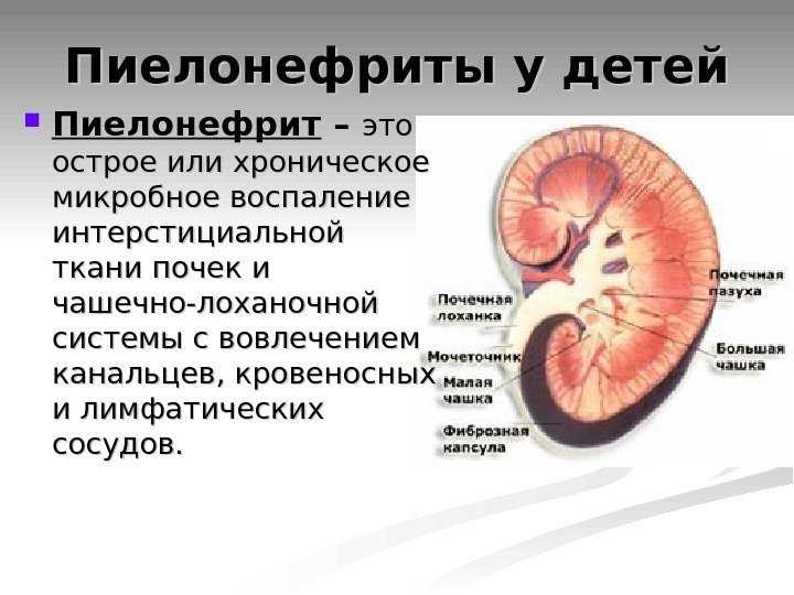 Пиелонефрит у беременных